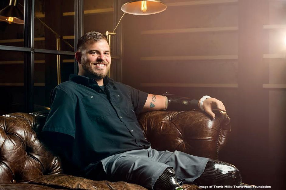 Life Is About Perspective for Veteran Amputee